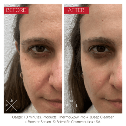 ThermoGlow Pro Bundle