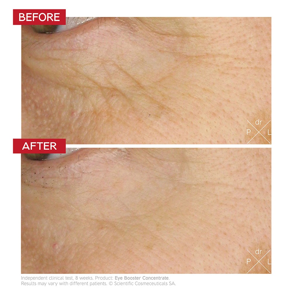 Eye Booster Concentrate | Dr. LEVY Switzerland