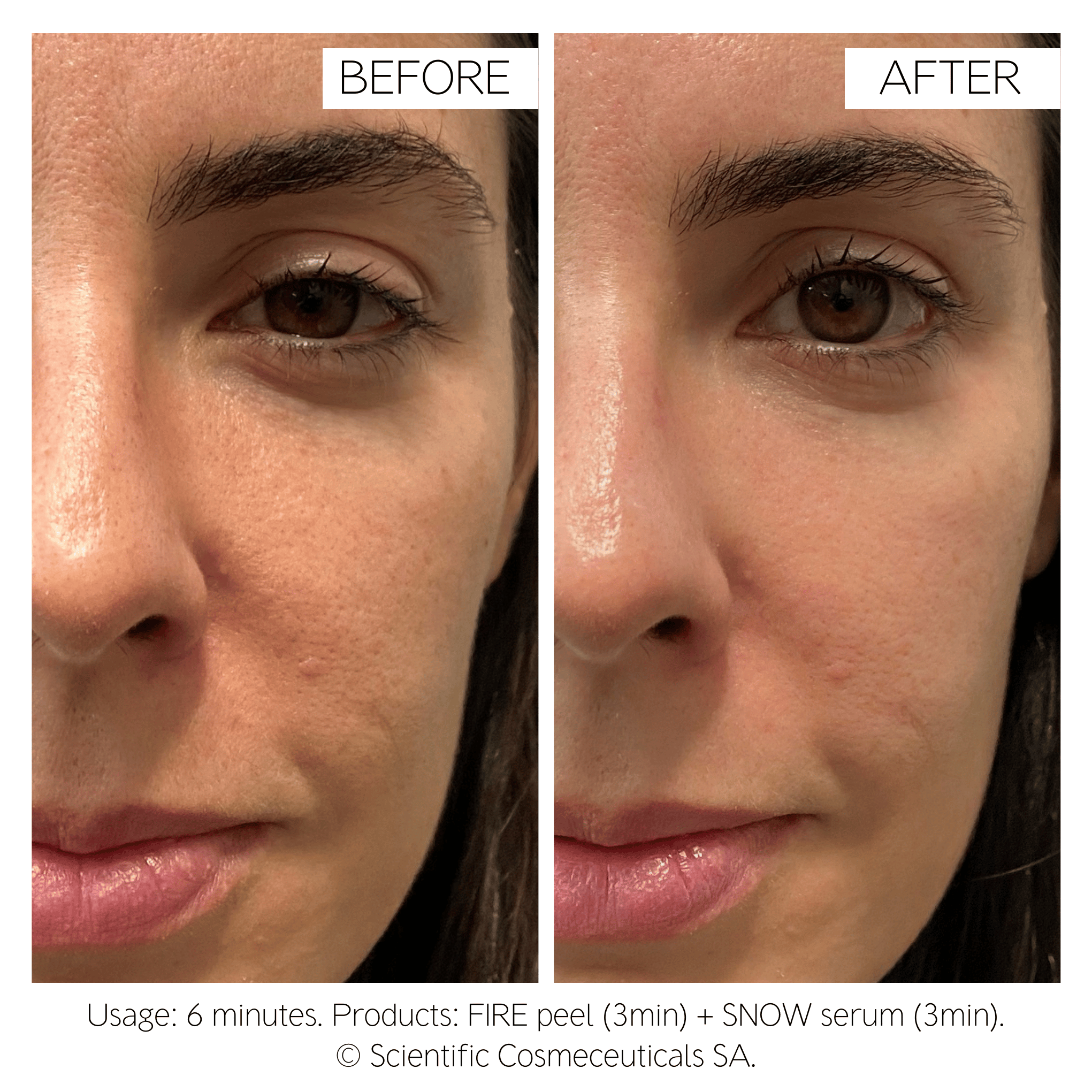 Fire & Snow - 5-Day Medi-cure