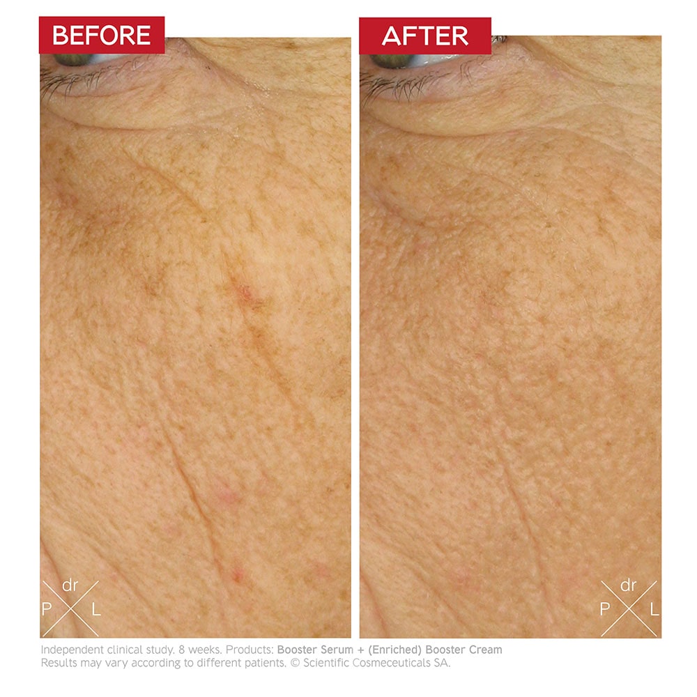dr-levy-switzerland-skin-care-beauty-product-enriched-booster-cream-before-after.jpg