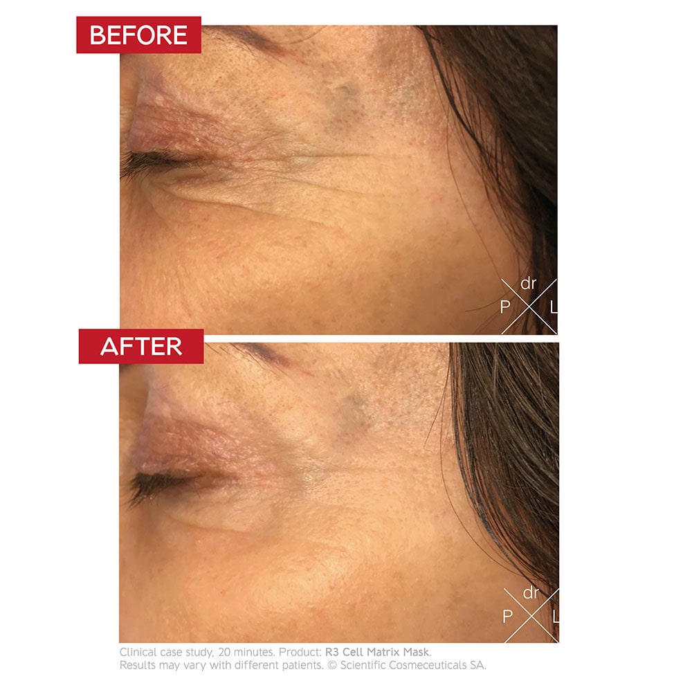 dr-levy-switzerland-skin-care-beauty-product-r3-cell-matrix-mask-before-after.jpg